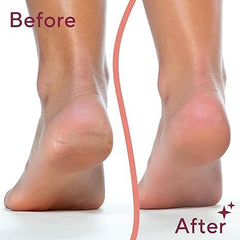 Flawless Pedi | The Ultimate Electronic Foot