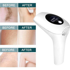 Laser Hair Removal System with 900,000 Flashes