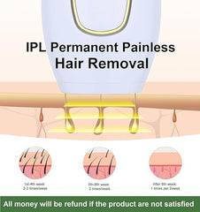 Home Use IPL Beauty Device