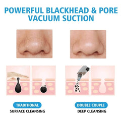 Electric Blackhead Vacuum Remover