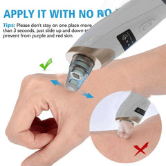 Electric Blackhead Vacuum Remover