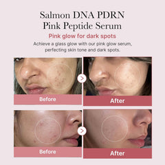 Medicube PDRN Pink Peptide Serum with Niacinamide
