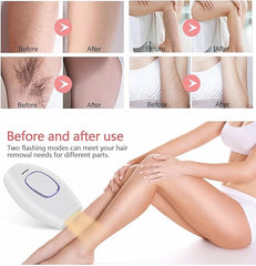 Home Use IPL Beauty Device